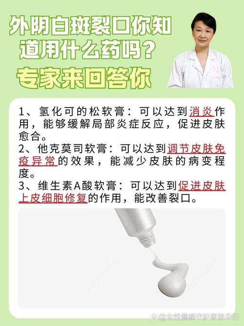 妇科白斑用什么药最好:妇科白斑怎么治疗才能彻底根除