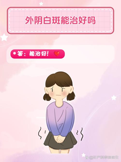 女性妇科白斑症状:妇科白斑是不是真的治不好